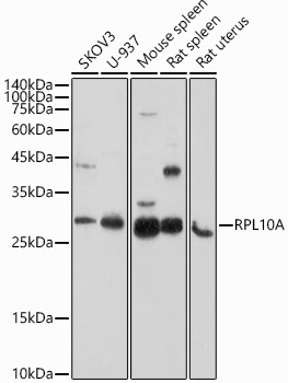 RPL10A Polyclonal Antibody