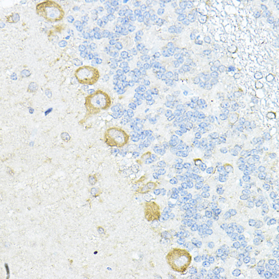 RPL10A Polyclonal Antibody