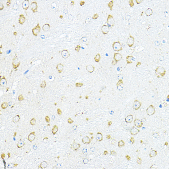 RPL10A Polyclonal Antibody