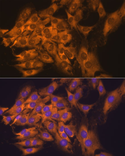 RPL17 Polyclonal Antibody
