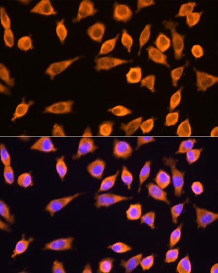 RPL17 Polyclonal Antibody
