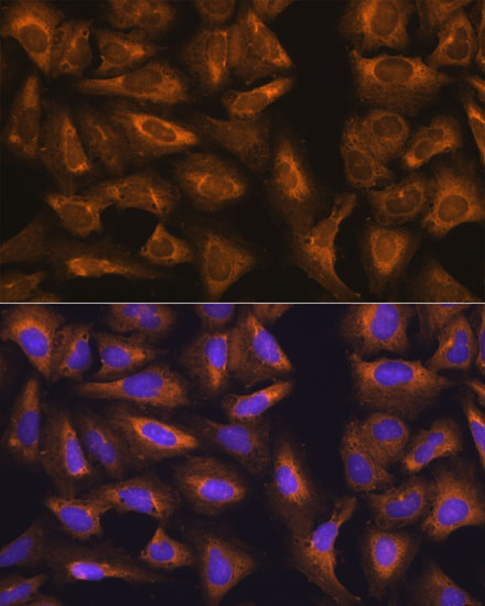 RPL17 Polyclonal Antibody