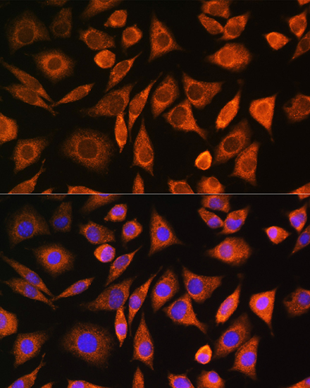 CNOT1 Polyclonal Antibody