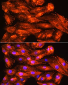 ZCCHC11 Polyclonal Antibody