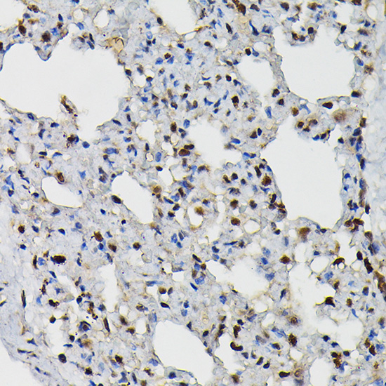 PRPF4 Polyclonal Antibody