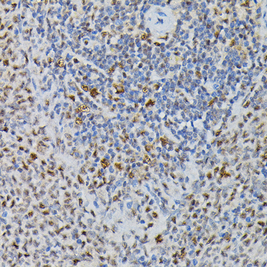 PRPF4 Polyclonal Antibody