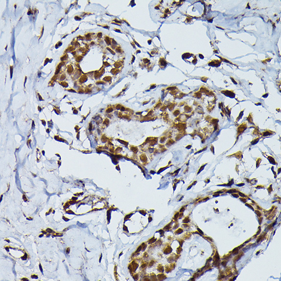 PRPF4 Polyclonal Antibody