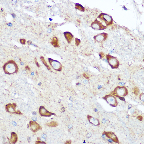 RPS6 Polyclonal Antibody