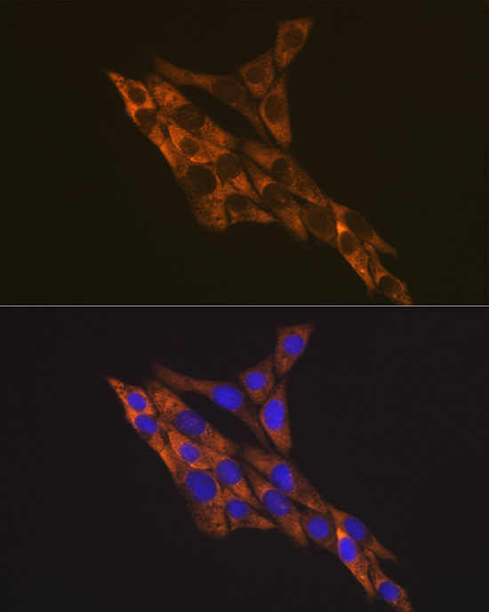 RPS6 Polyclonal Antibody