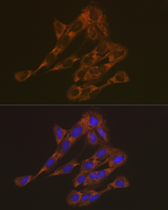 RPS6 Polyclonal Antibody