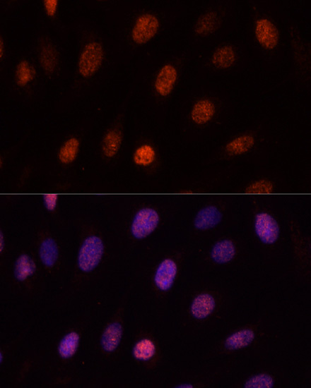 PCGF1 Polyclonal Antibody