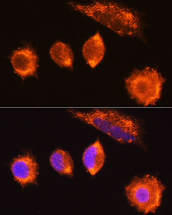 MGAT1 Polyclonal Antibody
