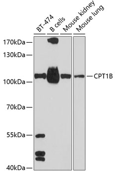 CPT1B Polyclonal Antibody