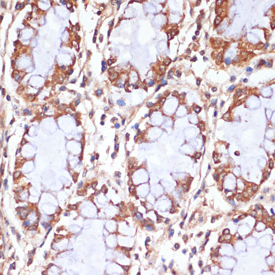 CPT1B Polyclonal Antibody