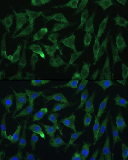 EIF2C2 Polyclonal Antibody