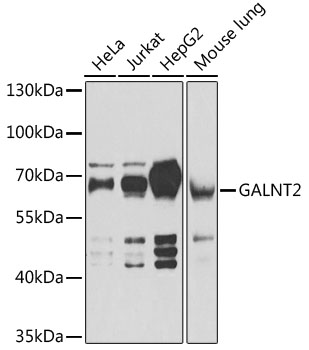 GALNT2 Polyclonal Antibody