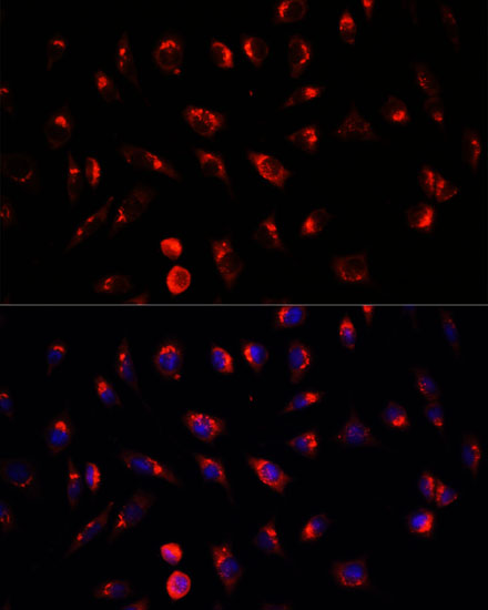 GALNT2 Polyclonal Antibody