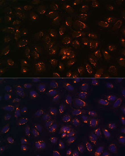 GALNT2 Polyclonal Antibody
