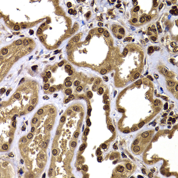 GPS1 Polyclonal Antibody