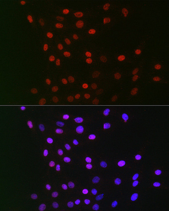 GPS1 Polyclonal Antibody