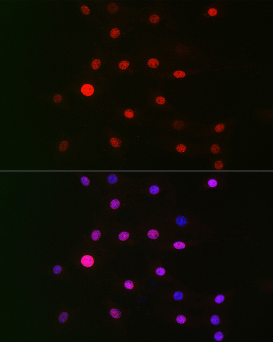 GPS1 Polyclonal Antibody