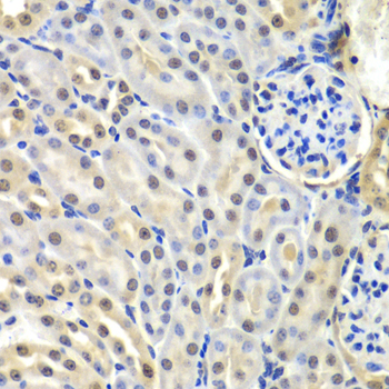 SNRPD2 Polyclonal Antibody