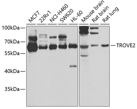 TROVE2 Polyclonal Antibody