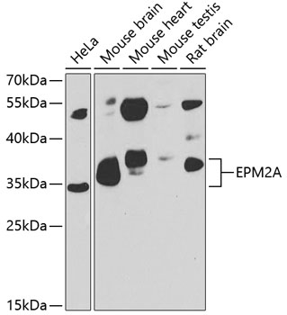 EPM2A Polyclonal Antibody