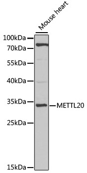 METTL20 Polyclonal Antibody
