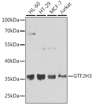 GTF2H3 Polyclonal Antibody