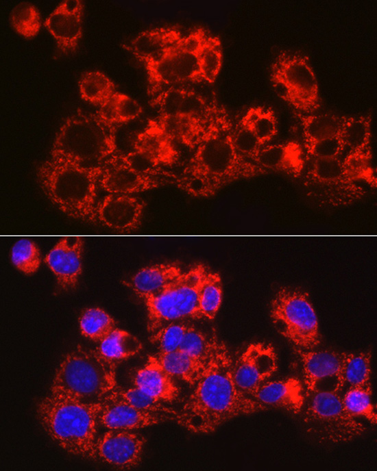 METTL7B Polyclonal Antibody