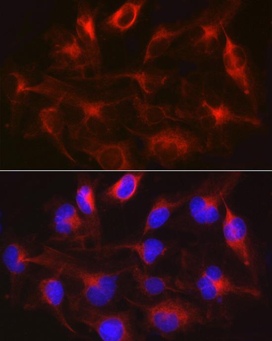 METTL7B Polyclonal Antibody