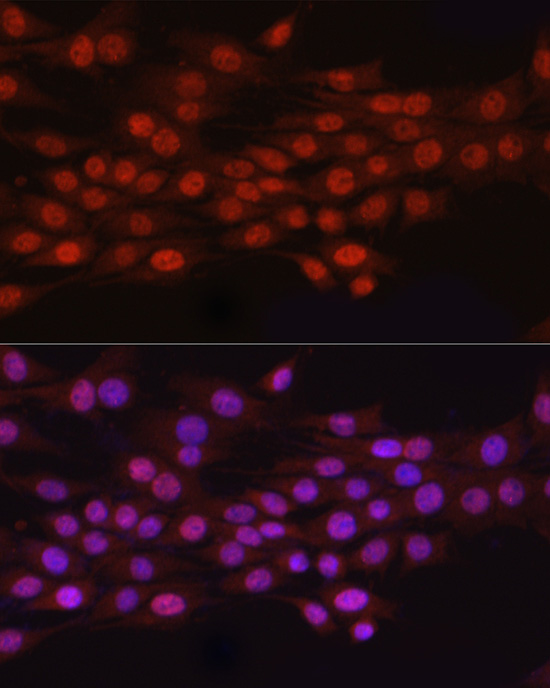 N6AMT1 Polyclonal Antibody