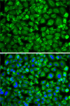 SAT2 Polyclonal Antibody