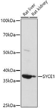 SYCE1 Polyclonal Antibody