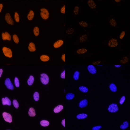 Acetyl-Histone H3-K14 pAb