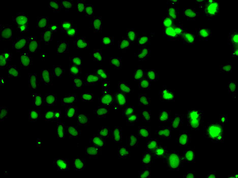 HMG20A Polyclonal Antibody