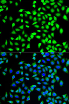 SGTA Polyclonal Antibody