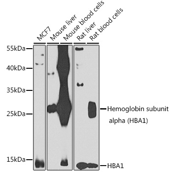 HBA1 Polyclonal Antibody
