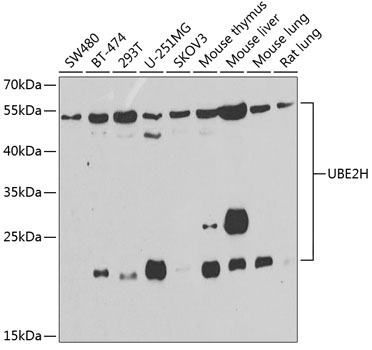 UBE2H Polyclonal Antibody