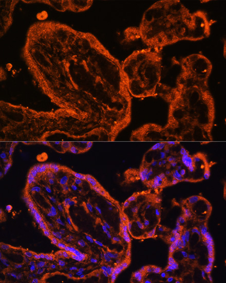 LDB3 Polyclonal Antibody