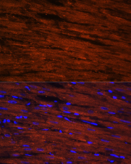 LDB3 Polyclonal Antibody