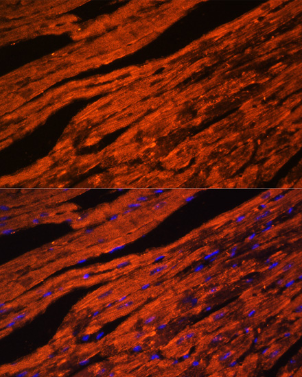 LDB3 Polyclonal Antibody