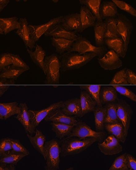 DAAM2 Polyclonal Antibody