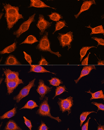 DAAM2 Polyclonal Antibody