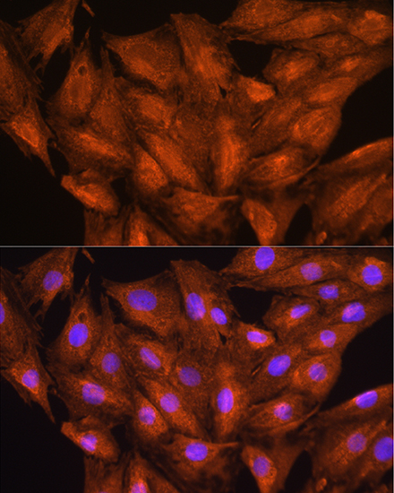 DAAM2 Polyclonal Antibody