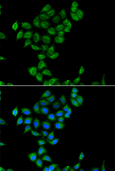 COQ3 Polyclonal Antibody