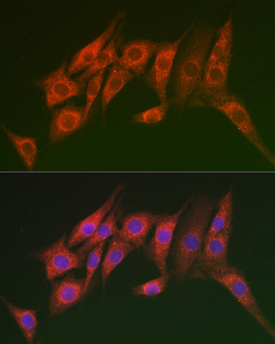 MTMR14 Polyclonal Antibody