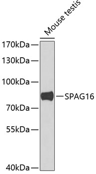 SPAG16 Polyclonal Antibody