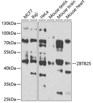 ZBTB25 Polyclonal Antibody